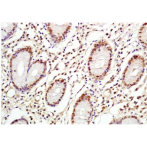 Anti-C-Myc antibody-致癌基因C-Myc抗体