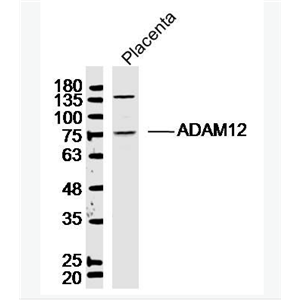 Anti-ADAM12 antibody-去整合素样金属蛋白酶12