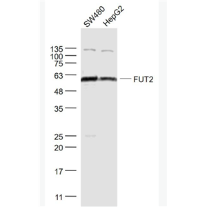 Anti-FUT2 antibody-岩藻糖转移酶2抗体