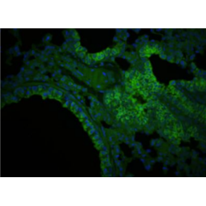 Anti-CTRP5 antibody-补体C1q和肿瘤坏死因子相关蛋白5抗体