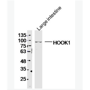 Anti-HOOK1 antibody-HOOK1蛋白抗体