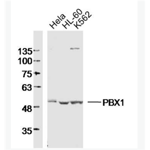 Anti-PBX1 antibody-B淋巴细胞白血病前体蛋白转录因子1抗体