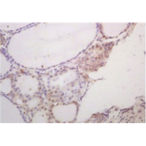 Anti-SCXA antibody-碱性螺旋-环-螺旋转录因子SCXA抗体,SCXA