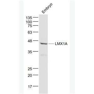 Anti-LMX1A antibody-同源盒转录因子LMX1A抗体