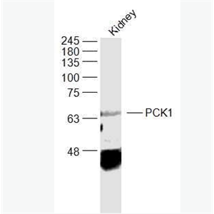 Anti-PCK1 antibody-磷酸烯醇丙酮酸羧激酶抗体,PCK1