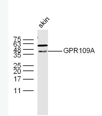 Anti-GPR109A antibody-G蛋白偶联受体109A抗体,GPR109A