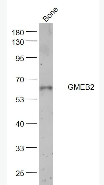 Anti-GMEB2 antibody-糖皮质激素调节元件结合蛋白2抗体,GMEB2