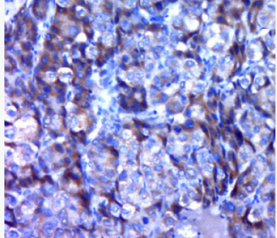 Anti-APOBEC3C antibody-載脂蛋白B-mRNA編輯酶復(fù)合物3C抗體,APOBEC3C