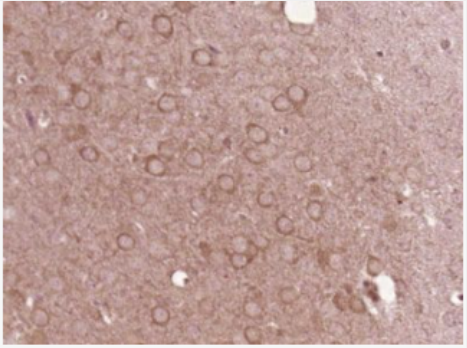 Anti-ARP2 antibody-肌動(dòng)蛋白相關(guān)蛋白2/3抗體,ARP2