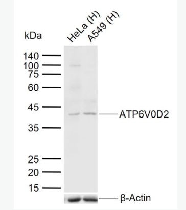 Anti-ATP6V0D2 antibody-ATP6V0D2蛋白抗体,ATP6V0D2