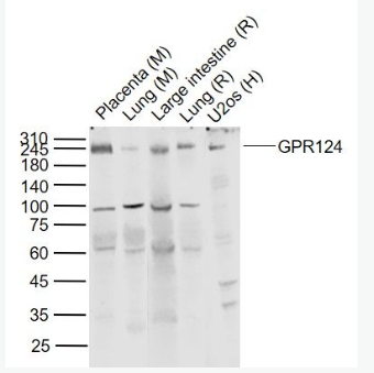 Anti-GPR124 antibody-腫瘤血管內(nèi)皮標(biāo)志物/G蛋白偶聯(lián)受體124抗體,GPR124