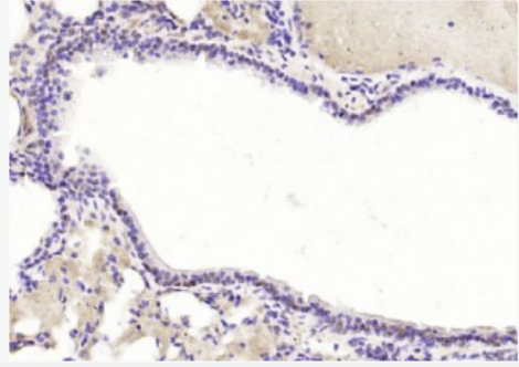 Anti-TRAF6BP antibody-肿瘤坏死因子受体相关蛋白6结合蛋白抗体,TRAF6BP