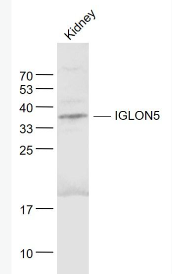 Anti-IGLON5 antibody-IgLON家族蛋白5抗體,IGLON5