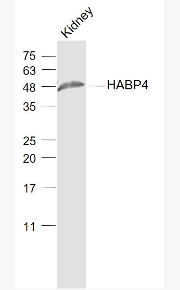 Anti-HABP4 antibody-透明質(zhì)酸結(jié)合蛋白4抗體,HABP4