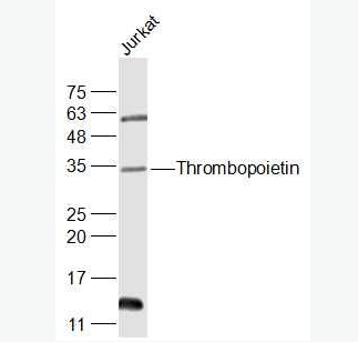 Anti-Thrombopoietin antibody-血小板生成素/巨核细胞集落刺激因子抗体,Thrombopoietin