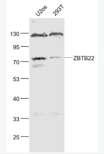 Anti-ZBTB22 antibody-鋅指蛋白297抗體,ZBTB22