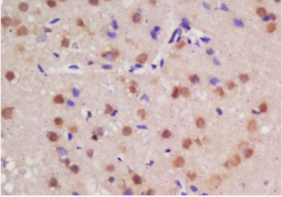 Anti-Guanylyl Cyclase alpha 1 antibody-鳥苷酸環(huán)化酶α1/GCS-α-1抗體,Guanylyl Cyclase alpha 1