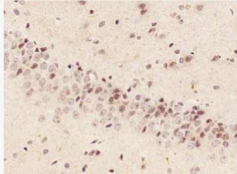 Anti-phospho-alpha B Crystallin (Ser59) antibody-磷酸化热休克蛋白β5/αb晶体蛋白质/α-晶体蛋白b链抗体,phospho-alpha B Crystallin (Ser59)