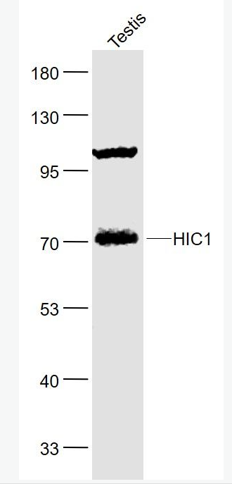 Anti-HIC1 antibody-肿瘤异常甲基化蛋白1抗体,HIC1