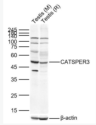 Anti-CATSPER3 antibody-陽離子通道精子相關(guān)蛋白3抗體,CATSPER3