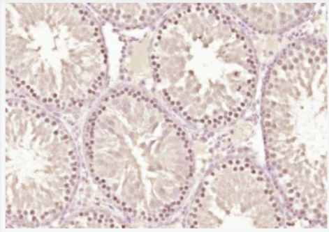 Anti-ZNF575 antibody-锌指蛋白575抗体,ZNF575