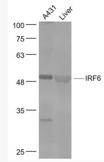 Anti-IRF6 antibody-干擾素調(diào)節(jié)因子6抗體,IRF6