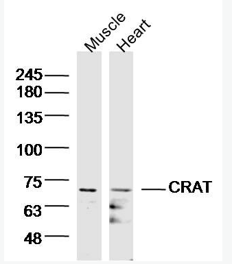 Anti-CRAT antibody-肉毒碱O-乙酰基转移酶,CRAT