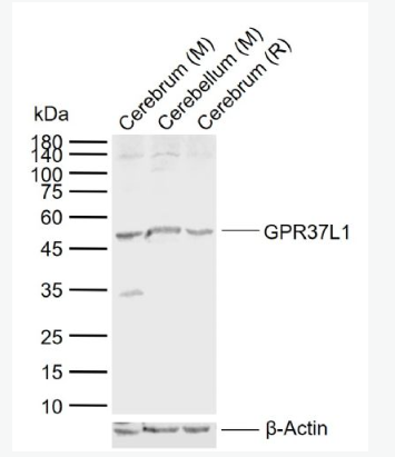 Anti-GPR37L1 antibody-G蛋白偶聯(lián)受體GPR37樣蛋白1抗體,GPR37L1