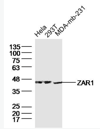 Anti-ZAR1 antibody-受精卵抑制蛋白1抗體,ZAR1