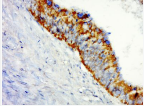 Anti-SHROOM1 antibody-SHROOM1蛋白抗体,SHROOM1