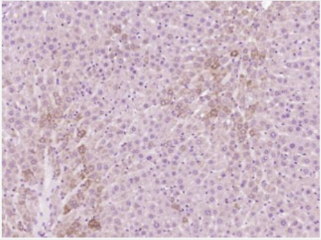 Anti-Phospho-Glycogen synthase 1 (Ser645) antibody-磷酸化葡萄糖合成酶1抗體,Phospho-Glycogen synthase 1 (Ser645)