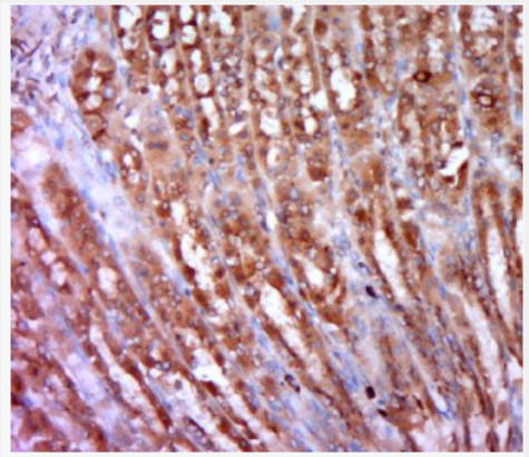 Anti-Smoothelin antibody-平滑肌蛋白抗體,Smoothelin