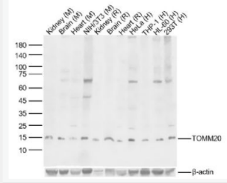 Anti-TOMM20 antibody-线粒体外膜受体Tom20抗体,TOMM20