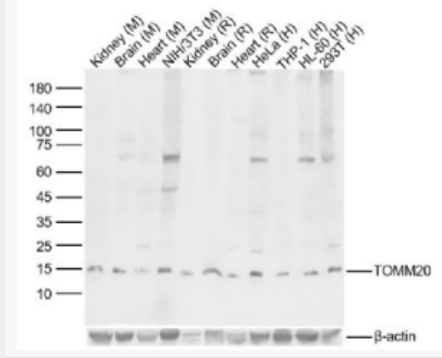 Anti-TOMM20 antibody-線粒體外膜受體Tom20抗體,TOMM20