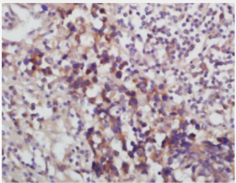 Anti-Desmoglein 2 antibody-桥粒芯糖蛋白2抗体,Desmoglein 2