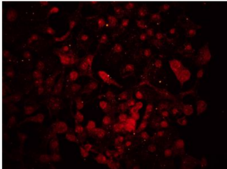 Anti-DACT1 antibody-肝癌新基因3蛋白抗体,DACT1