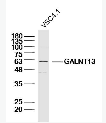 Anti-GALNT13 antibody-多肽N-乙酰氨基半乳糖转移酶13抗体,GALNT13