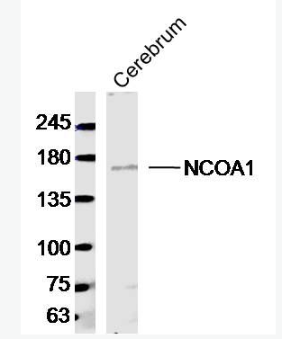 Anti-NCOA1/KAT13A antibody-核受体共激活剂1抗体,NCOA1/KAT13A