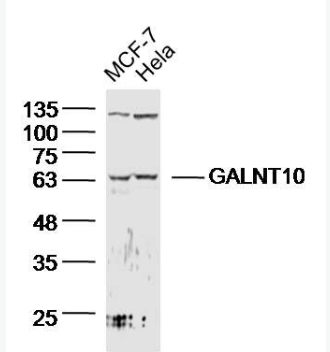 Anti-GALNT10 antibody-多肽N-乙酰氨基半乳糖轉(zhuǎn)移酶10抗體,GALNT10