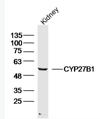 Anti-CYP27B1 antibody-细胞色素P450 27B1抗体,CYP27B1