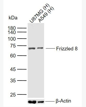 Anti-Frizzled 8antibody-卷曲蛋白8抗體,Frizzled 8