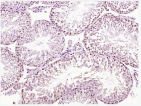 Anti-SCP3 antibody-膽堿磷酸轉(zhuǎn)移酶1抗體,SCP3