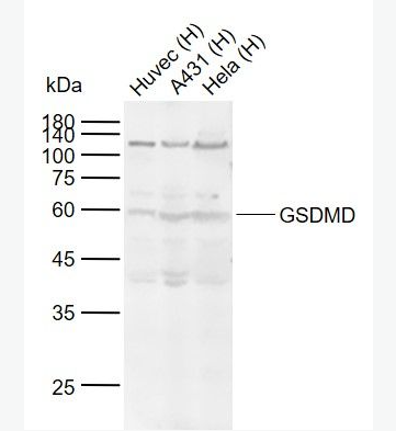 Anti-GSDMD antibody-Gasdermin D蛋白抗體,GSDMD