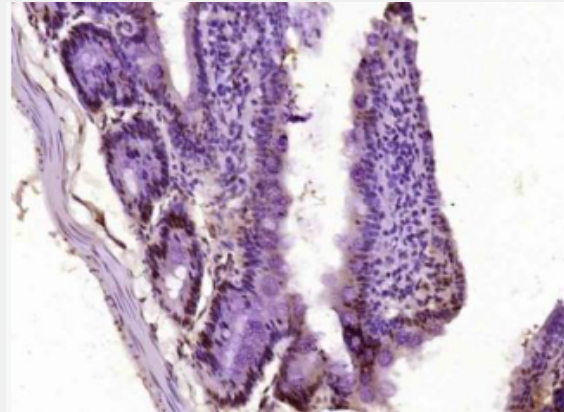 Anti-phospho-AMPK alpha-1 (Ser184) antibody-磷酸化腺苷單磷酸活化蛋白激酶α1抗體,phospho-AMPK alpha-1 (Ser184)