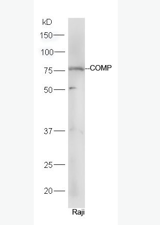 Anti-COMP antibody-软骨寡聚基质蛋白抗体,COMP