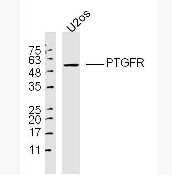 Anti-PTGFR antibody-前列腺素F2a受体抗体PGF2αR,PTGFR