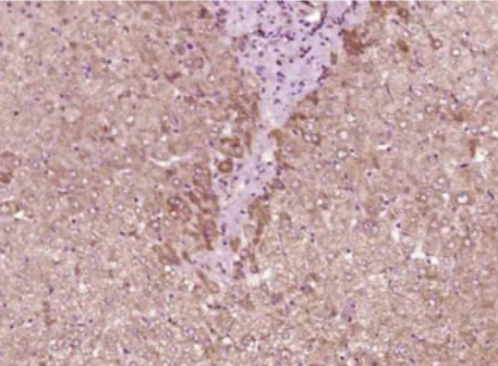 Anti-IL-9 antibody-白介素9抗体,IL-9