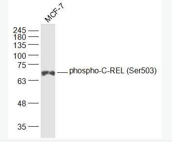 Anti-phospho-C-REL (Ser503) antibody-磷酸化淋巴细胞衍生C-型凝集素抗体,phospho-C-REL (Ser503)