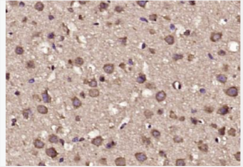 Anti-FOXK1 antibody-FOXK1蛋白抗体,FOXK1