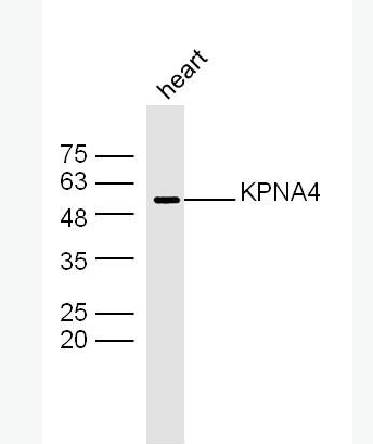 Anti-KPNA4 antibody-KPNA4蛋白抗体,KPNA4